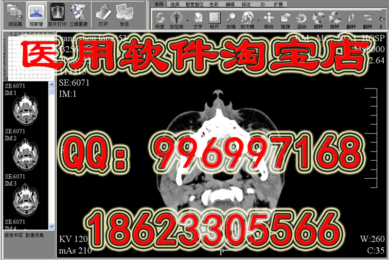 DICOM数字软件、CT影像工作站、X光机软件