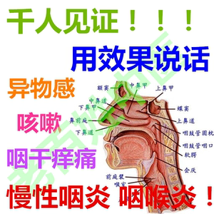 慢性咽炎茶咽喉炎 异物感咳嗽滤泡 恶心咽干咽