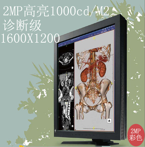 摄影神作显示器 2MP彩色高亮医用显示器RX2