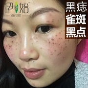 美容金水取脸部痣美容院专用仪A器笔点斑水去雀斑水点痦子无痕正