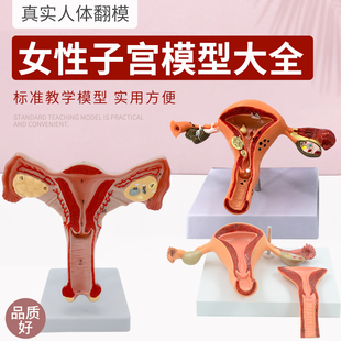 仿真子宫模型 病理子宫输卵管解剖 病态子宫 计生指导演示模型