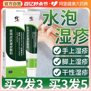 水泡湿疹手部汗疱手上起长小水泡去汗状疱疹膏止痒汗泡专用根软膏