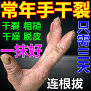 专治手裂的药膏脚裂脚后跟开裂手指裂口手脚脱皮干燥粗糙皲裂专用