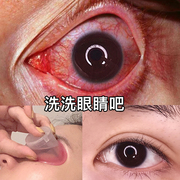 日本春日井洗眼液清洁抗菌消炎止痒去黄去红血丝补水缓解眼睛疲劳