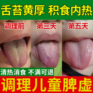 脾胃虚弱调理儿童中药贴小儿健脾贴膏消积食去内热脾虚泡脚包JA