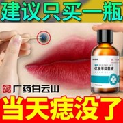 点痣膏无痕净痣膏祛膏药水，美容专用肉去痣，神器黑点除志