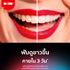 一口大白牙泰国k高露热感，美白牙膏清洁牙龈，牙齿男女成人微笑神器