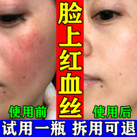 去脸上有的红血丝修复角质层角质层，薄敏感肌，面部泛红高原红修复