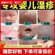 湿疹膏婴儿专用儿童宝宝湿疹口水疹无激素干性保湿秋冬面霜身体乳