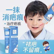儿童祛疤膏脸上去疤膏专用小孩去疤痕修复除疤，膏淡伤疤专用烫伤