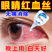 眼睛红血丝修复去除滴眼液去黄消除眼屎多粘稠缓解眼疲劳模糊