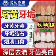 去牙渍牙垢黄牙速效洗牙齿，污垢除牙石烟渍的牙膏，抗敏去口臭美白tu