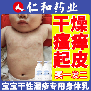 儿童宝宝身体乳干性湿疹婴宝湿疹婴儿专用润肤霜止痒去根无激素A