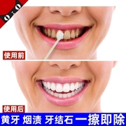 小苏打牙齿美白牙膏速效去除黄牙，烟渍牙结石去黄去口臭去牙渍洗白