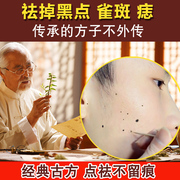 去痣点痣膏无痕祛痣药水脸部去斑祛斑痦子取痣除痣黑点神器笔