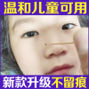 韦医生除痣灵点痣神器点痣水，雀斑专用去痣膏脸部点痣膏无痕