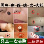 消志去肉痣无痕脱痣膏消痣，药水修复素点雀除志灵去痦子黑痣