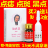 点痣膏无痕药水脸部祛痣祛斑痦子取痣贴去痣黑痣去除黑点神器