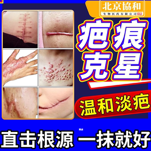 祛疤膏去疤痕灵巴修复膏，除疤手术烫伤疤痕，淡化剖腹产非日本进口dz