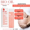 Bio Oil 200ml Specialist Skincare 生物护肤油去痘印妊娠纹