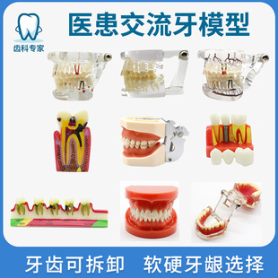 口腔牙科牙模型教学模型可拆卸分解修复体种植牙模型模具