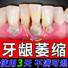 牙龈萎缩牙周炎牙齿松动牙结石缝隙，变大口腔清洁护理非修专用牙膏