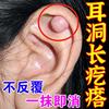 耳洞增生疙瘩耳洞耳道红肿化浓疤痕凸起去除疙瘩防耳朵发焱清理液