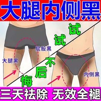 大腿根部去黑内侧腋下美白去黑腋窝，除黑屁股除男女黑色素沉淀神器