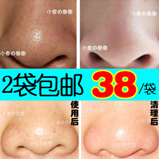 恋夜轩 纯中药去黑头面膜 收毛孔 祛黑头导出女 2袋包邮 告别鼻贴