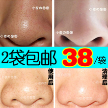 恋夜轩 纯中药去黑头面膜 收毛孔 祛黑头导出女 2袋包邮 告别鼻贴