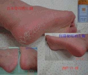 竹炭纤维内衣保暖吗