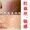 【女人我最大推荐】XUESU雪夙KGF-II原液修复红血丝、过敏、痘印