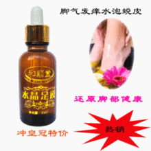 庆皇冠 和顺堂水晶足膜 脚癣 脚气股癣手癣 不满意退款