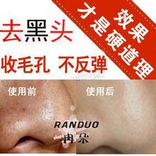 -纯中药 去黑头面膜 祛黑头面膜粉 黑头导出面膜