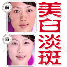 热卖 纯中药 美白霜 可淡斑去痘印 美白淡斑霜